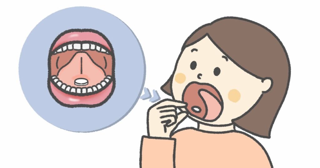 シダキュア処方